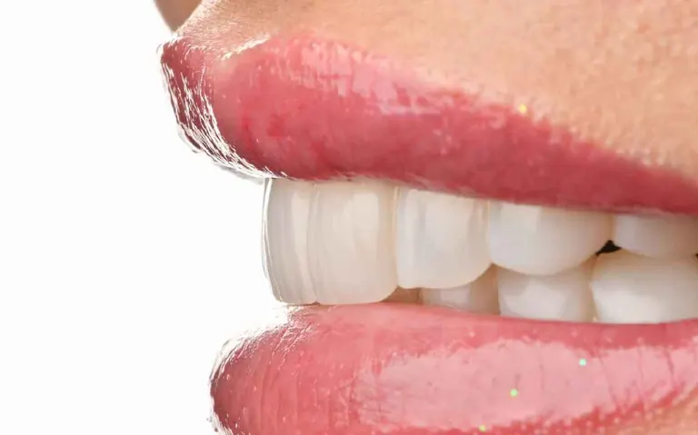 نمونه‌کار زیبایی ۵